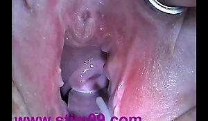 Cum Launching run wide Syringe in Cervix Utherus after Shagging
